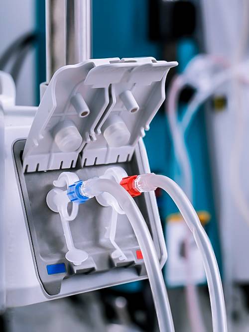 Innovations and Advances in Dialysis Equipment